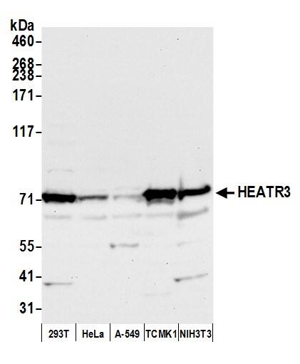 HEATR3 Antibody