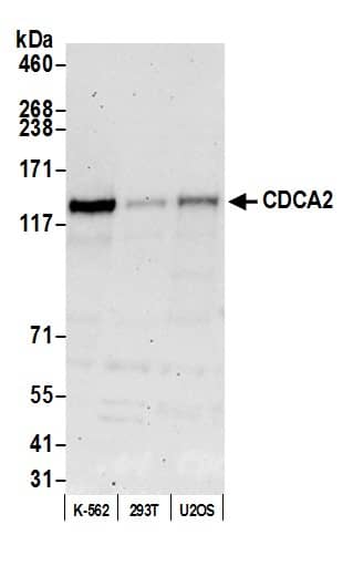 CDCA2 Antibody