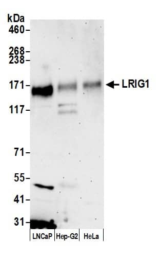 LRIG1 Antibody