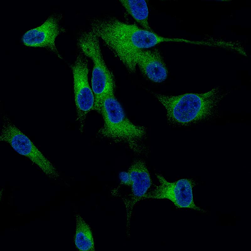 Melan-A/MART-1 Antibody (CL12874) - BSA Free Immunocytochemistry/ Immunofluorescence: Melan-A/MART-1 Antibody (CL12874) [NBP3-18548]