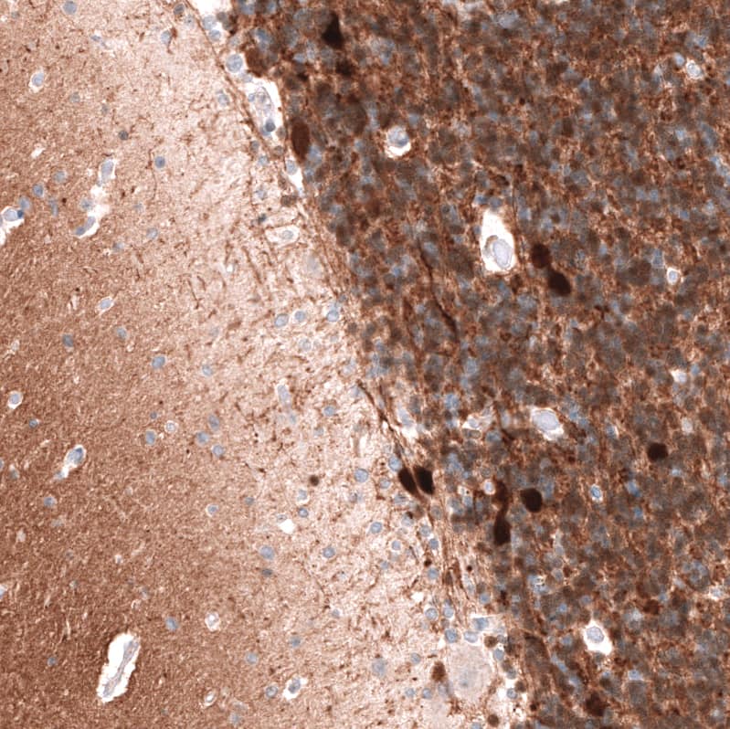 Calretinin Antibody (CL12838) - BSA Free Immunohistochemistry-Paraffin: Calretinin Antibody (CL12838) [NBP3-18561]