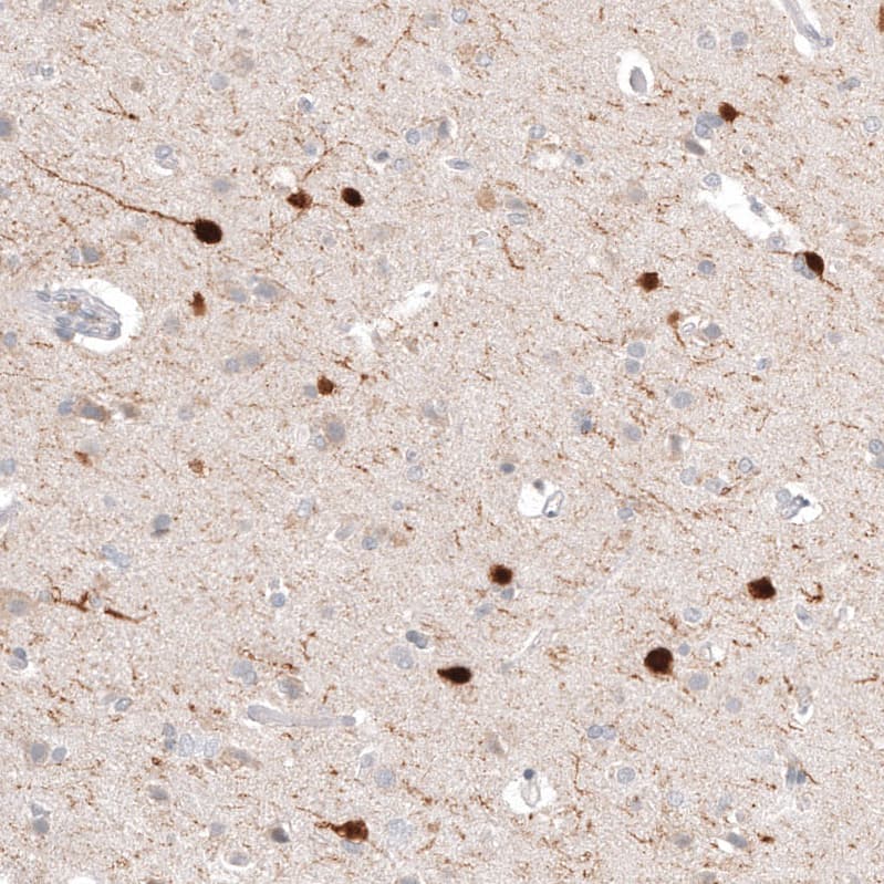 Calretinin Antibody (CL12838) - BSA Free Immunohistochemistry-Paraffin: Calretinin Antibody (CL12838) [NBP3-18561]
