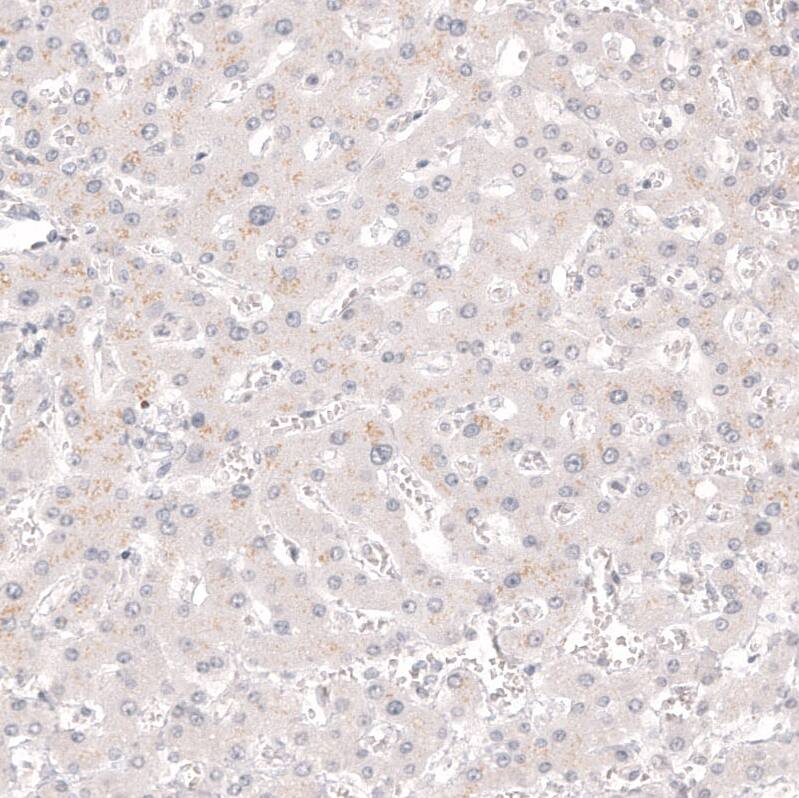 Calretinin Antibody (CL12838) - BSA Free Immunohistochemistry-Paraffin: Calretinin Antibody (CL12838) [NBP3-18561]