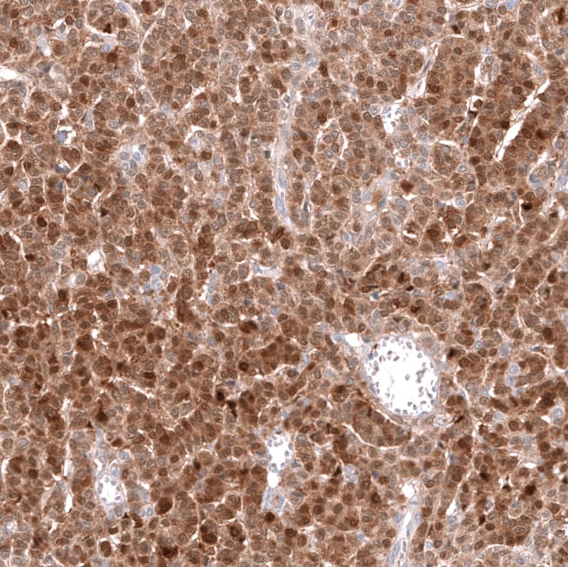Calretinin Antibody (CL12838) - BSA Free Immunohistochemistry-Paraffin: Calretinin Antibody (CL12838) [NBP3-18561]
