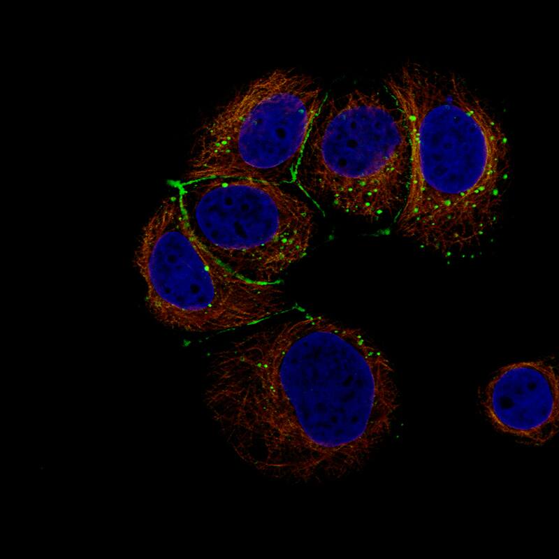 Claudin-3 Antibody (CL13128) - BSA Free Immunocytochemistry/ Immunofluorescence: Claudin-3 Antibody (CL13128) [NBP3-18577]