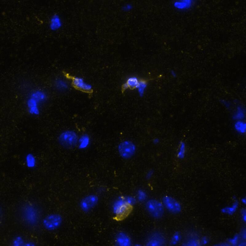 STING/TMEM173 Antibody (2922D) - BSA Free Multiplex Immunofluorescence: STING/TMEM173 Antibody (2922D) - BSA Free [NBP3-18816] -