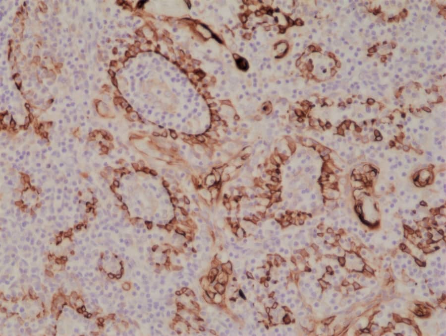 Cytokeratin 17 Antibody (RM351)