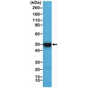 Cytokeratin 17 Antibody (RM351)