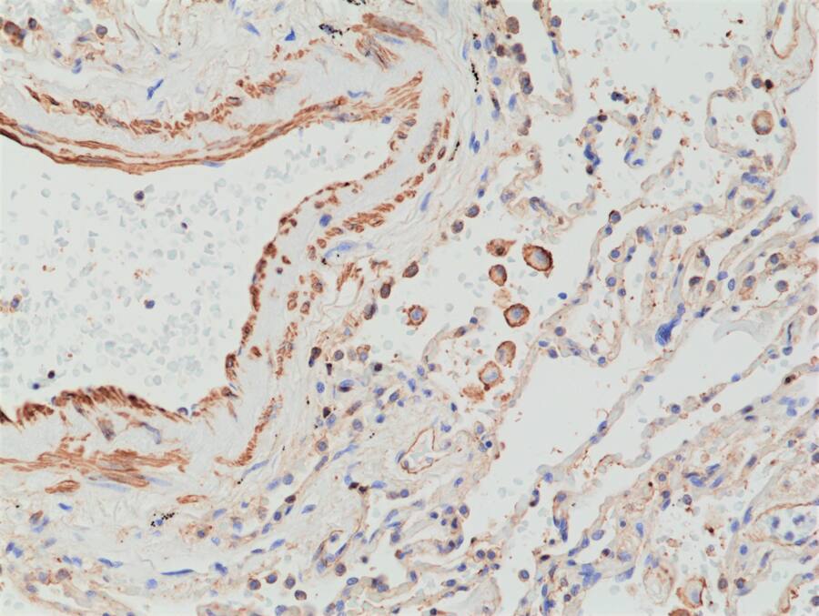 MMP-12 Antibody (RM381)