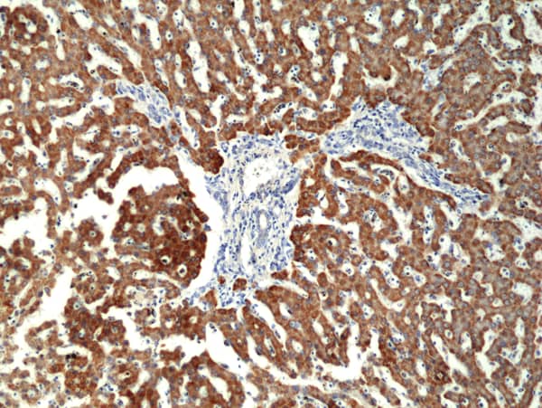 CPS1 Antibody (RM395)