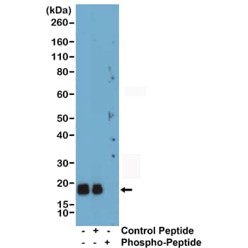 Myosin Light Chain 2 Antibody (RM484)