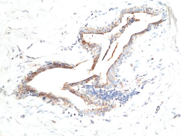 Fibrillin 1 Antibody (RM463)