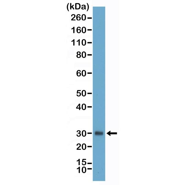 Fibrillin 1 Antibody (RM463)