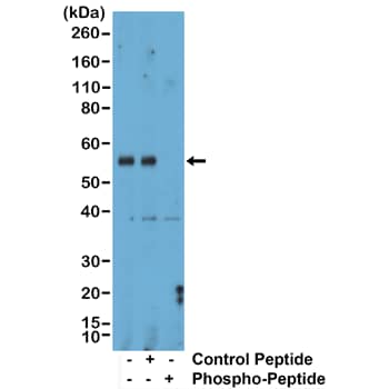 SMAD1/5/9 Antibody (RM487)