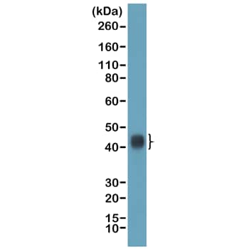 TIA1 Antibody (RM490)