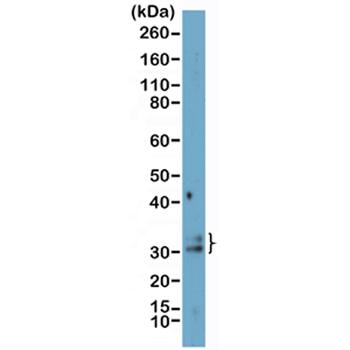 GADD153/CHOP Antibody (RM485)