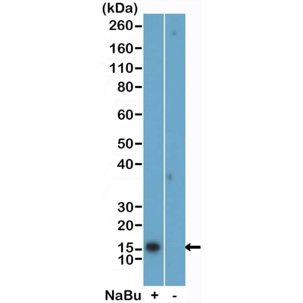 Histone H2B [ac Lys5] Antibody (RM455)