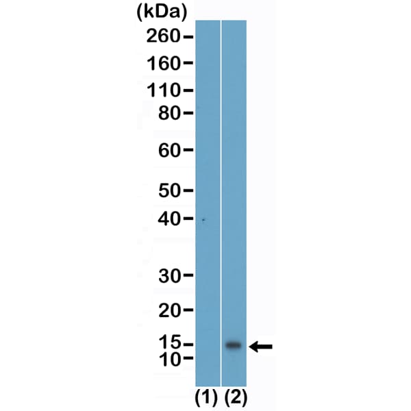 Histone H4 [Monomethyl Lys5] Antibody (RM457)