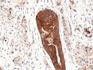 VEGF 165 Antibody (RM391)