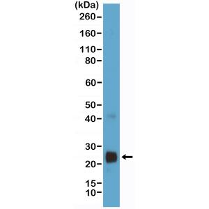 VEGF 165 Antibody (RM391)