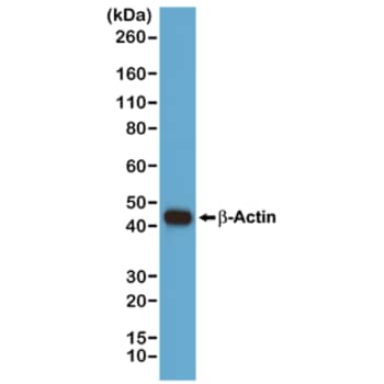 beta-Actin Antibody (RM112)