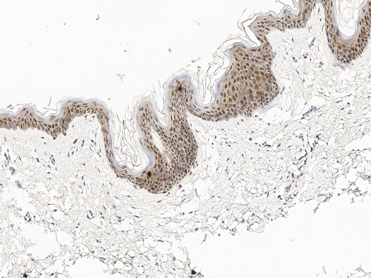 PHGDH Antibody