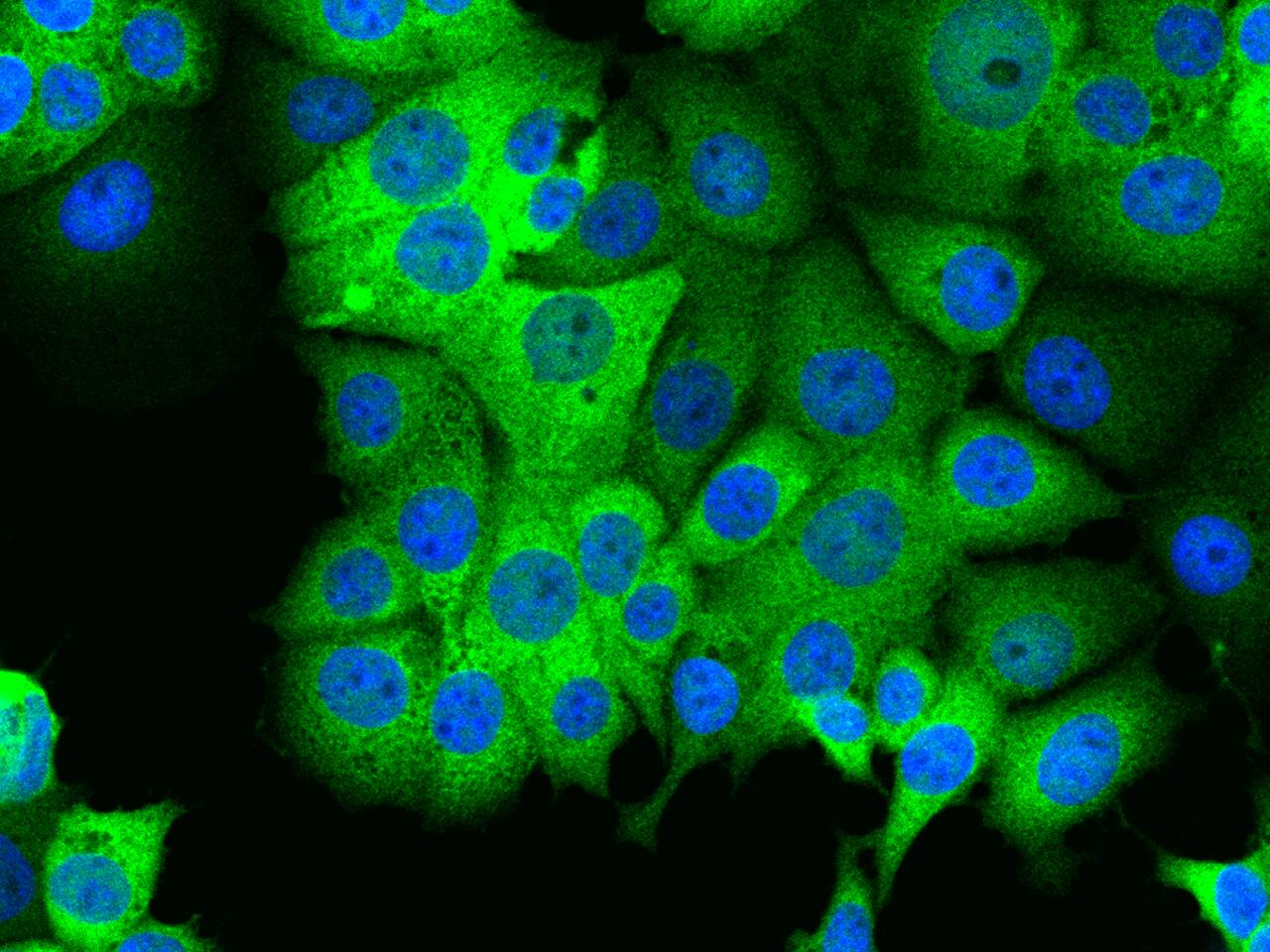 PHGDH Antibody - BSA Free