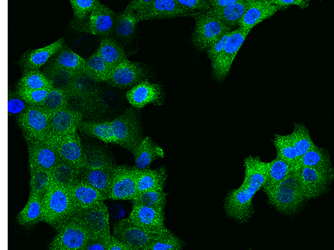 RAB11B Antibody - Azide and BSA Free