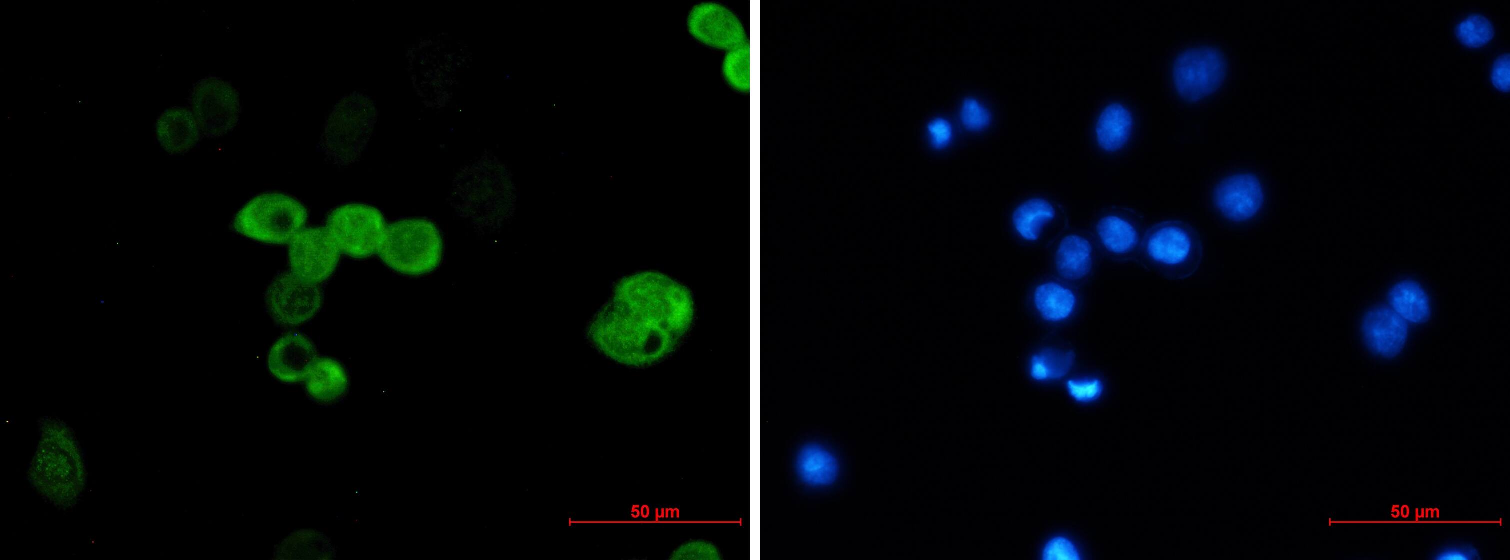 CRABP2 Antibody (S01-4C4)