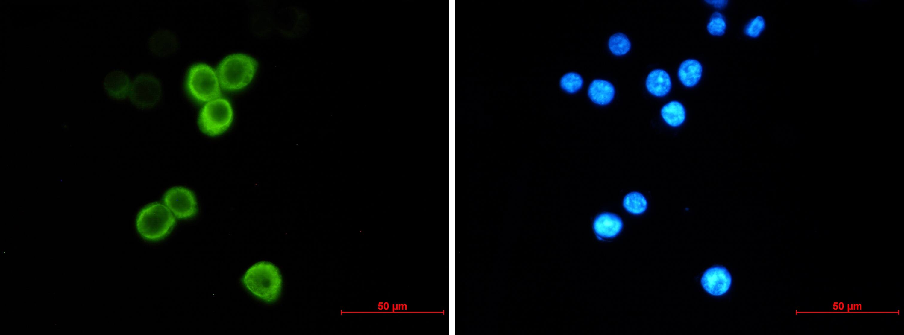 AG-2/AGR2 Antibody (S04-1H6)