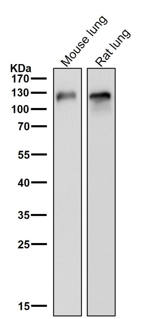 MCAM/CD146 Antibody (S05-5A2)