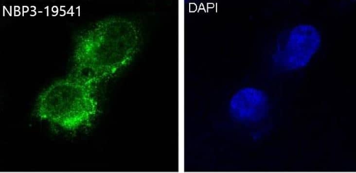 MCAM/CD146 Antibody (S05-5A2)