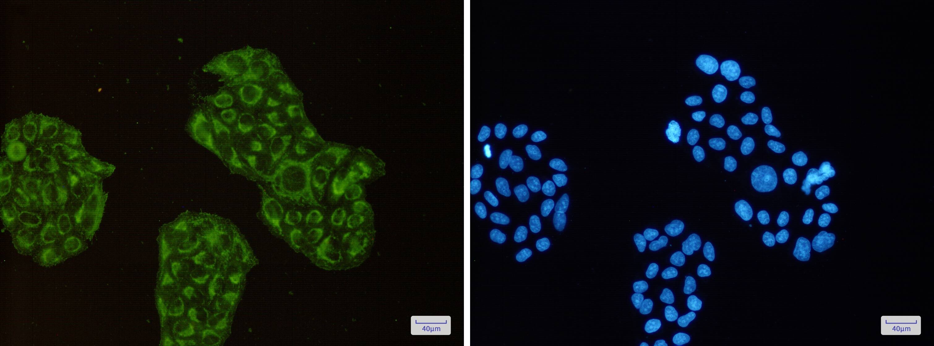 ACADM Antibody (S06-8F7)