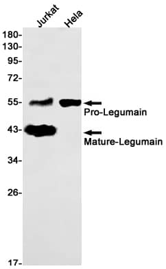 Legumain/Asparaginyl Endopeptidase Antibody (S06-7G1)