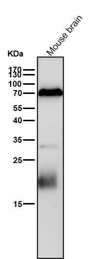 PCPTP1 Antibody (S01-8G2)