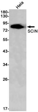 SCIN Antibody (S07-6G2)