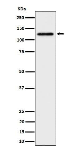 SPINK5 Antibody (S06-6C1)