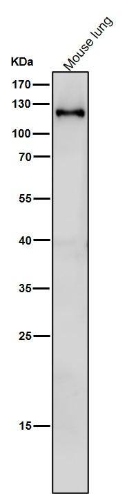 SPINK5 Antibody (S06-6C1)