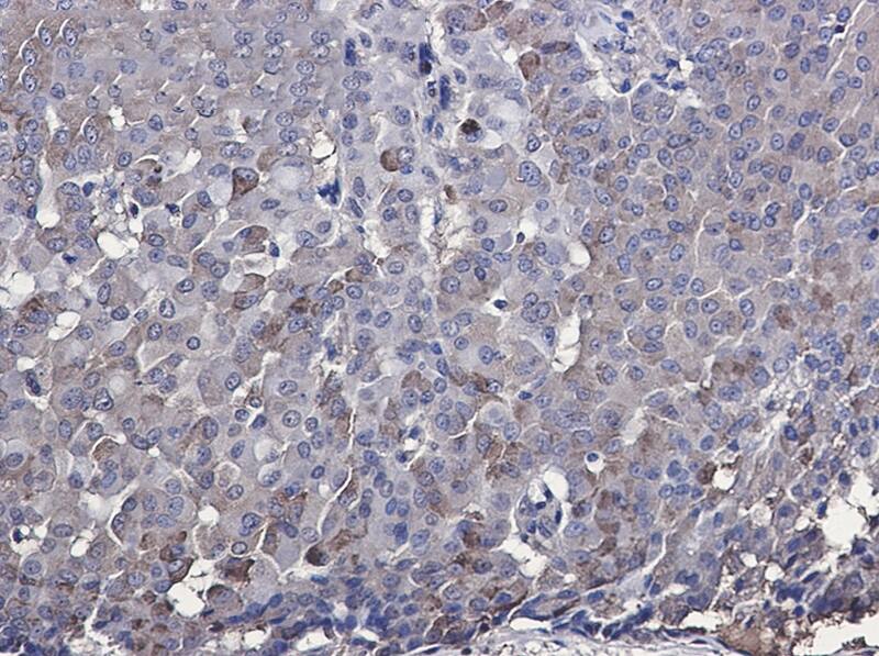 IRF7 Antibody (S04-1E1)