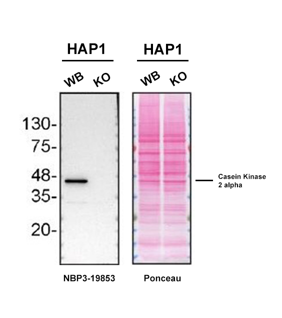 Casein Kinase 2 alpha Antibody (S05-7F8)