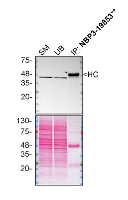 Casein Kinase 2 alpha Antibody (S05-7F8)