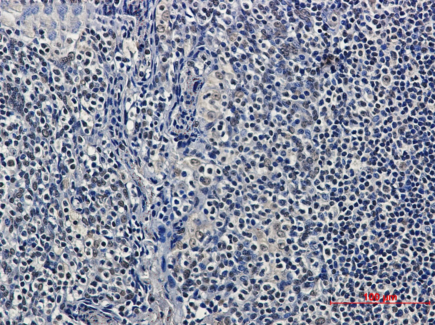 HDAC9 Antibody (S01-8I6)