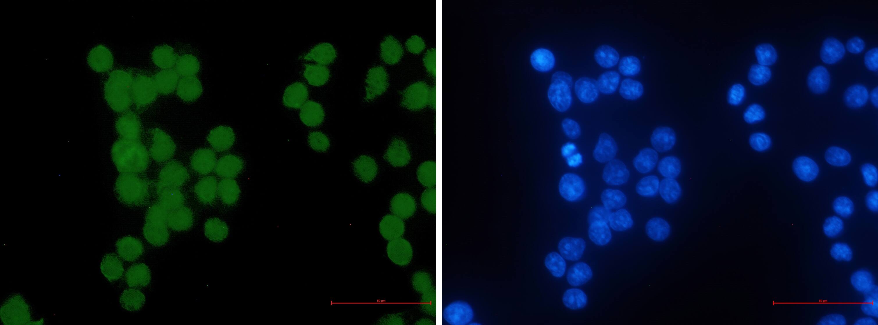 HIPK2 Antibody (S06-5G2)