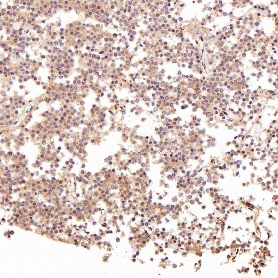 LRP-1 Antibody (S09-4E8)