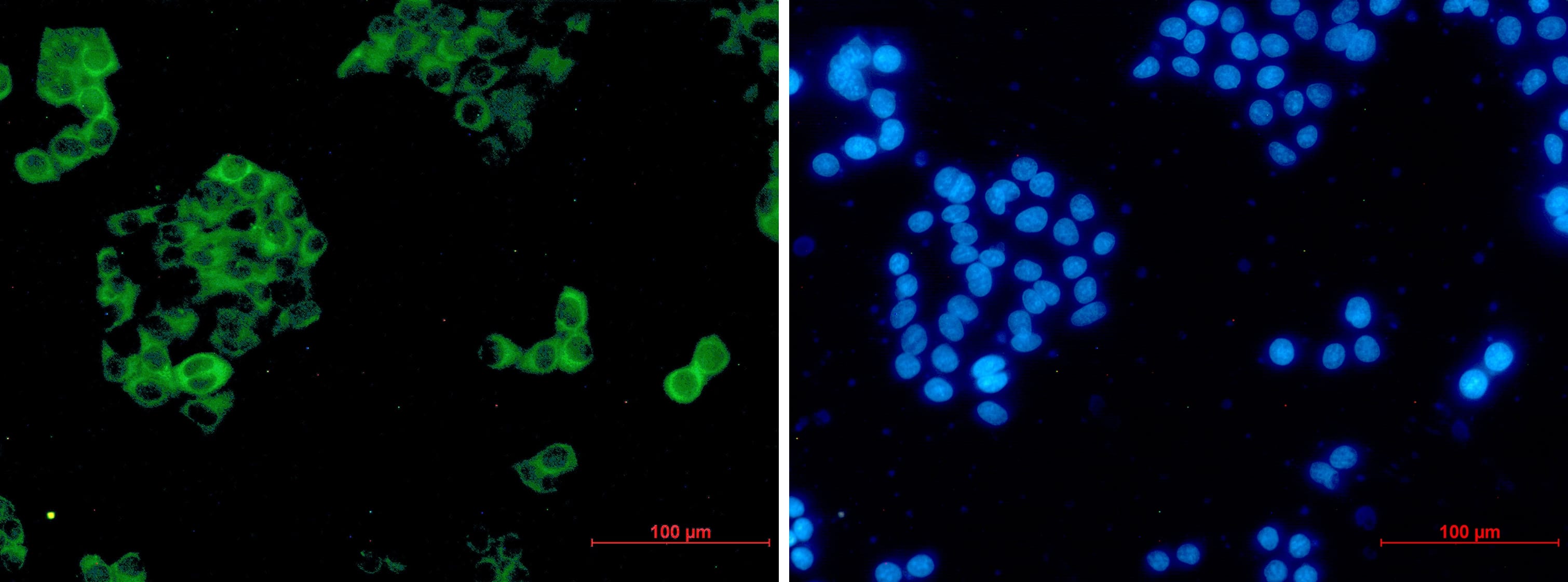 Insulysin/IDE Antibody (S04-4E8)