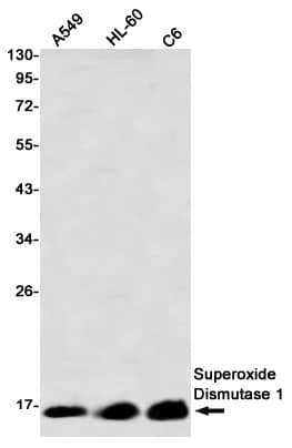 SOD1/Cu-Zn SOD Antibody (S08-5A5)