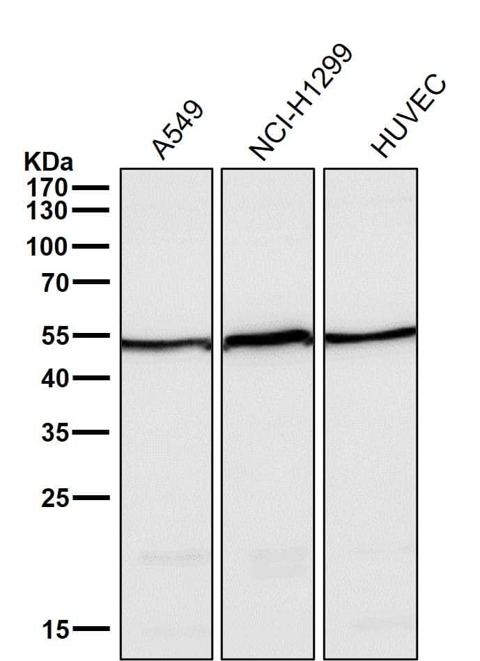 Angiopoietin-2 Antibody (S04-7E6)