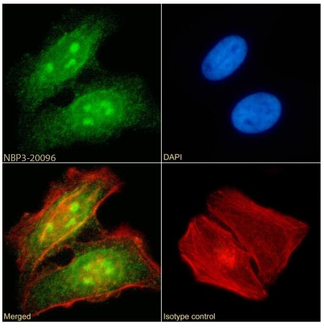 hHR23b Antibody (SAIC-28A-29) - Azide and BSA Free
