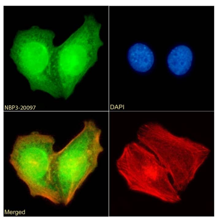 hHR23b Antibody (SAIC-28B-8) - Azide and BSA Free