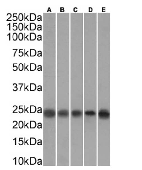 Transgelin/TAGLN/SM22 alpha Antibody (SAIC-33B-129) - Azide and BSA Free